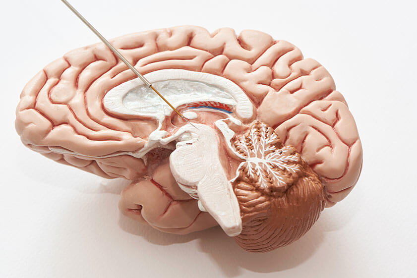 What Is The Connection Between Alzheimer's and Parkinson's Diseases?