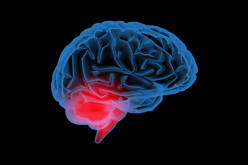 What Are The 4 A's Of Alzheimer's Disease? | TerraBella